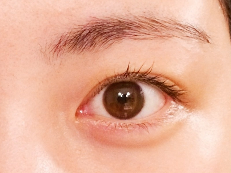 痛い 光 奥 が が の 眩しい 目 【虹彩炎】片目が充血してめっちゃ痛い!たった1日で治した方法は目薬